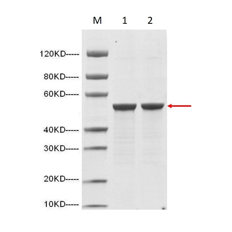 SARS-CoV-2 Nucleocapsid protein (His Tag) E.coli 100μg,  Z03480-100