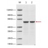 SARS-CoV-2 Nucleocapsid protein (His Tag) E.coli 100μg,  Z03480-100