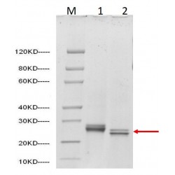 SARS-CoV-2 Spike protein (RBD, His Tag), 500ug, nr kat. Z03479-500