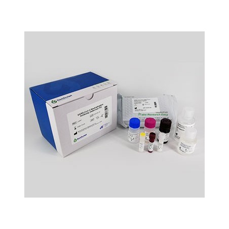 cPass™ SARS-CoV- 2 Neutralization Antibody Detection Kit, CE IVD
